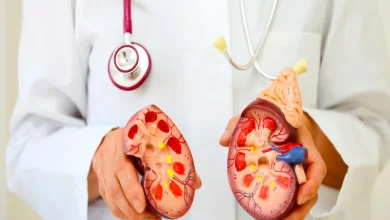 آیا مشروبات الکلی به دفع سنگ کلیه کمک می‌کنند؟