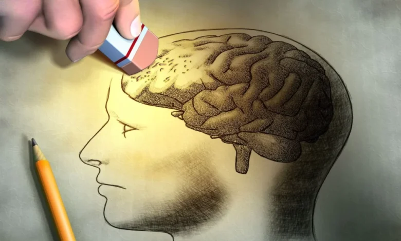 آلزایمر