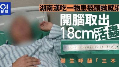 شرط‌بندی مرگبار با مار؛ کرم زنده سال‌ها در مغز مرد چینی زندگی می‌کرد! + عکس